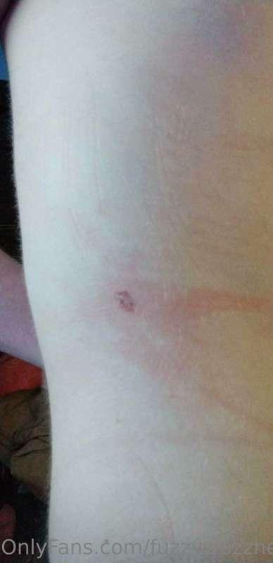 fuzzywuzzher image #0