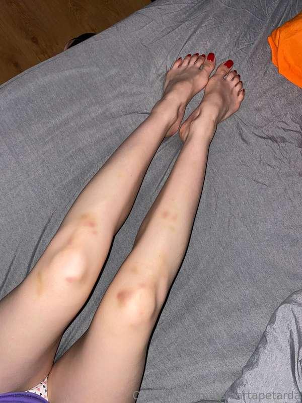 Very long ballet legs 👌🏻🍓 and red nails on my sexy toes ❤️