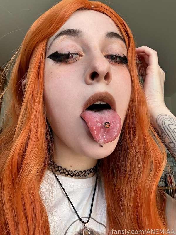 anemiaa image #1