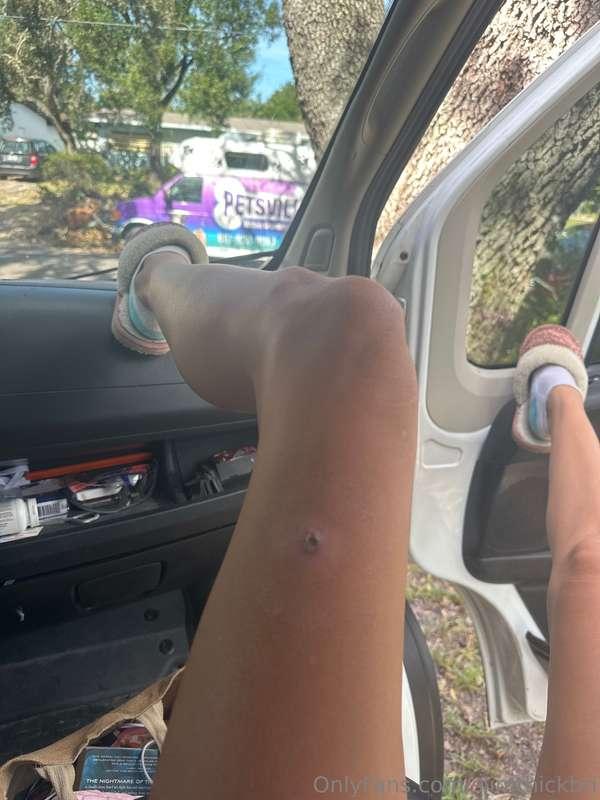 Between having a rando spider bite get infected on my leg (I..