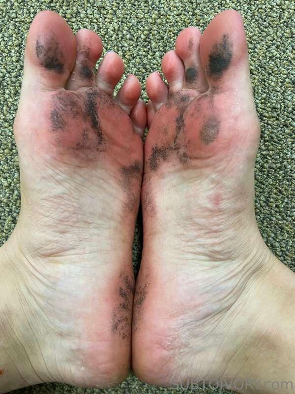 The results of walking on a treadmill bare foot.