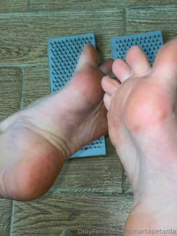 My feet after standing on toe nails 😲🦶🏻