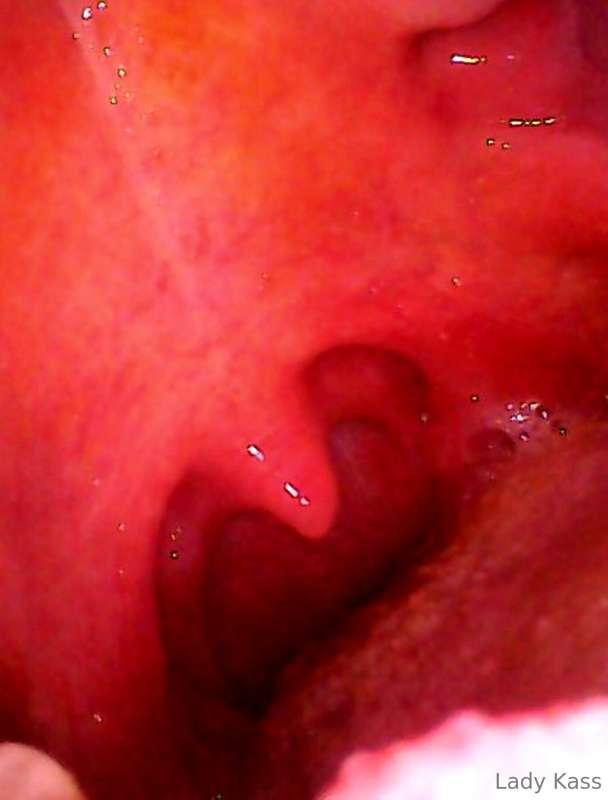 Anyone interested in this fabulous pic of my mouth? I was ab..