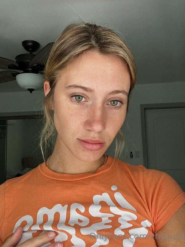 face covered in... freckles 😉