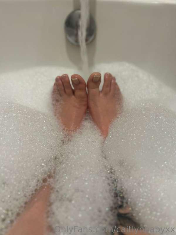 Cute toes even though they are all scared up from my pups lo..