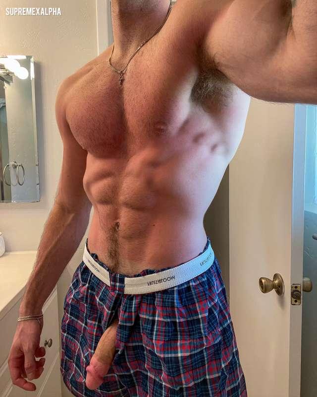 sunburnt 😫😫
