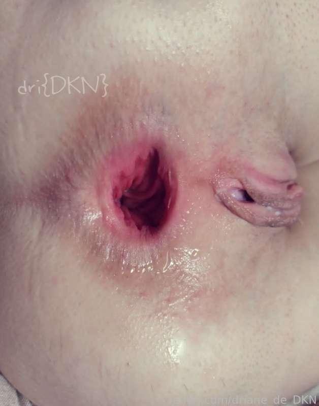 driane_de_dkn image #1