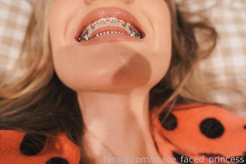 brace_faced_princess image #13