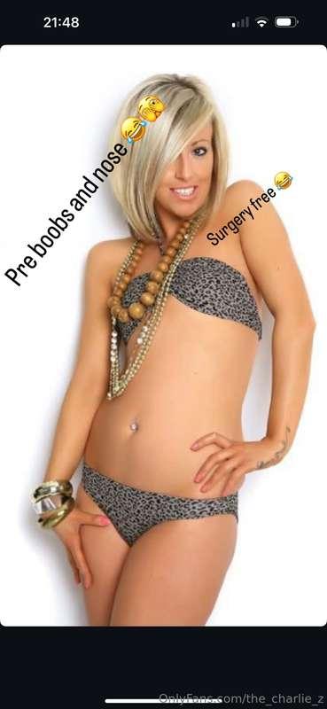 So many people ask to see thisNo big tattoosNo surgery Natur..