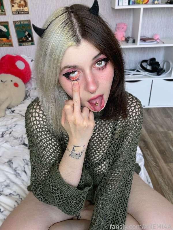 anemiaa image #1
