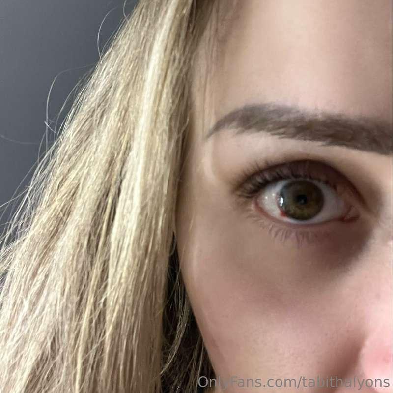 **A not so pretty post** the last week or so I’ve had bloood..