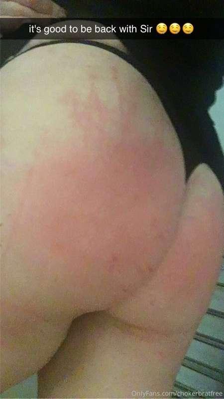 see the real bruises at @chokerbrat ;)
https://onlyfans.com/..