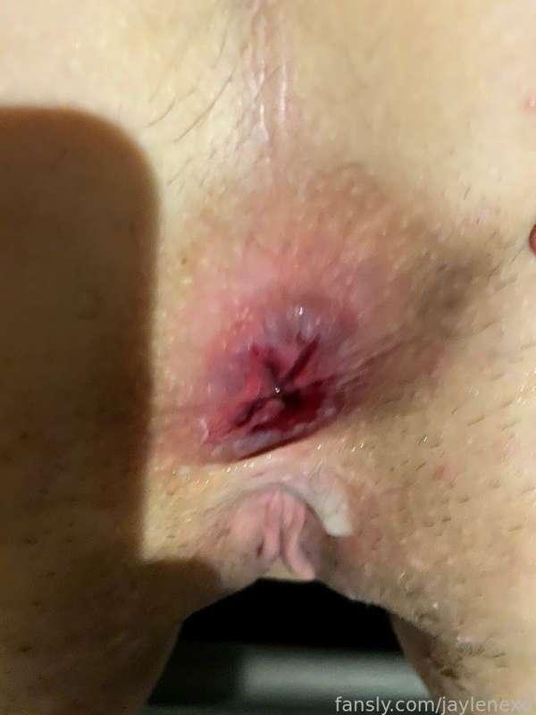 My gaping asshole after being fucked