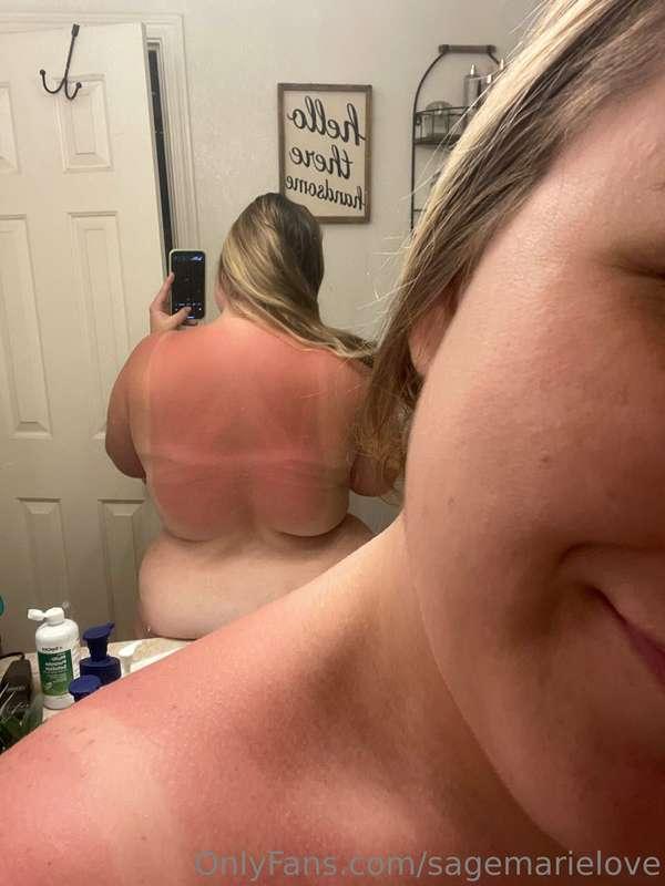 Come put some aloe on me🥺😆