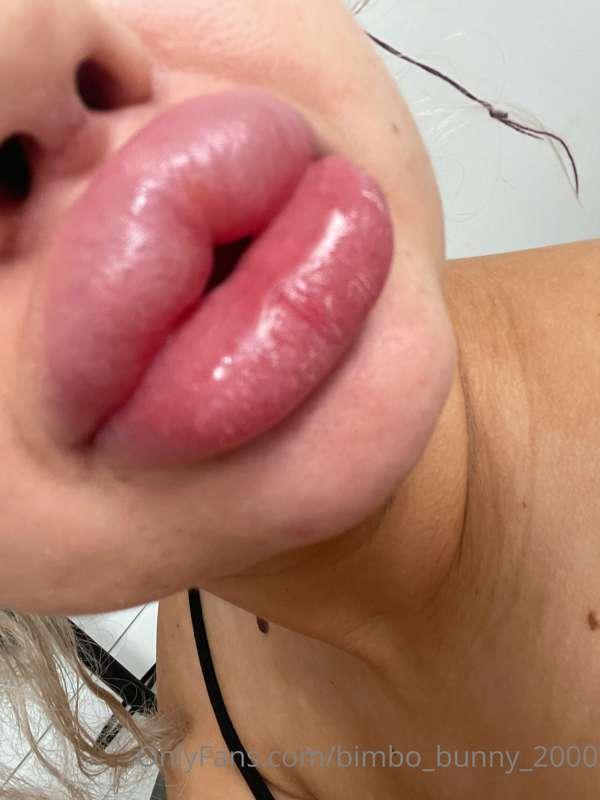 These big lips will get bigger today 💕💕💕 at least 3-5cc at o..