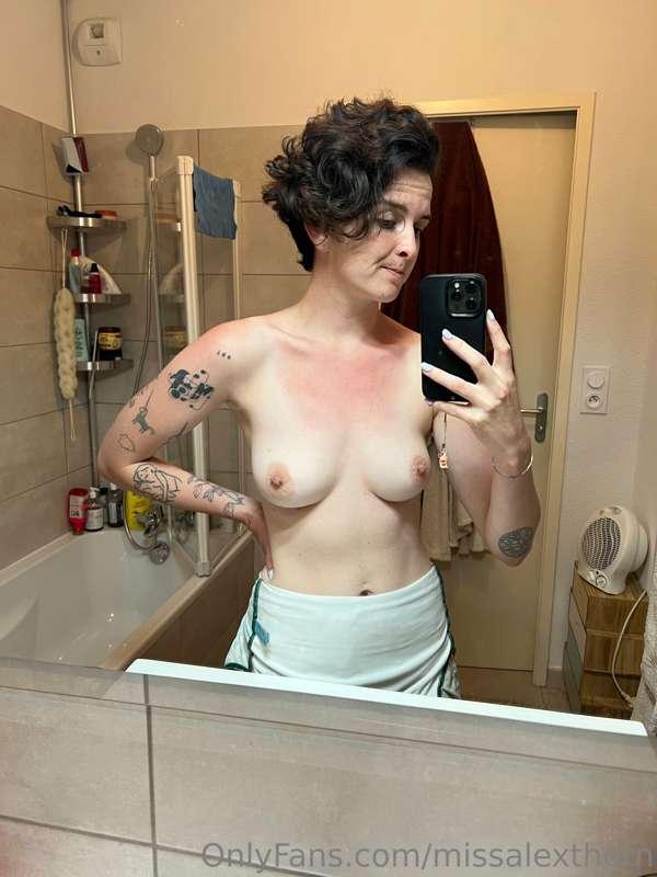Got a little burnt 😒