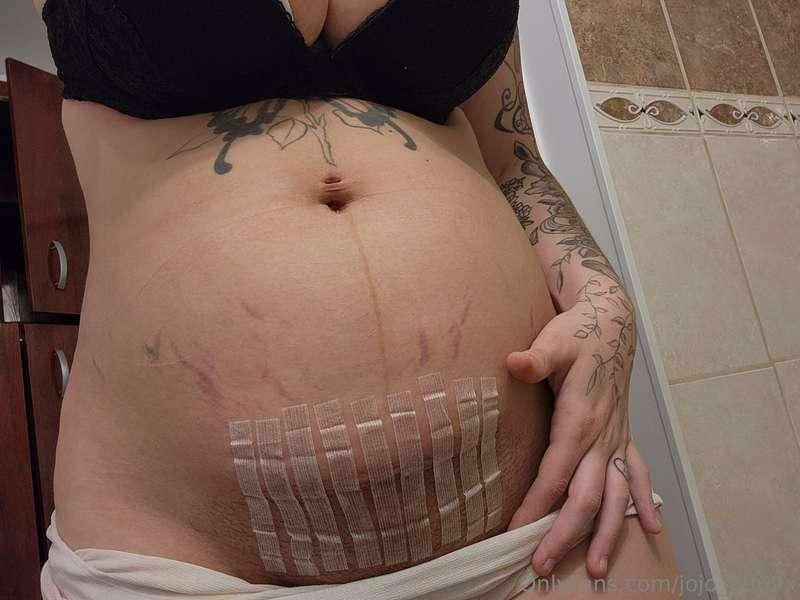 I'm no longer pregnant, i gave birth April 28 ❤️ i've had a ..