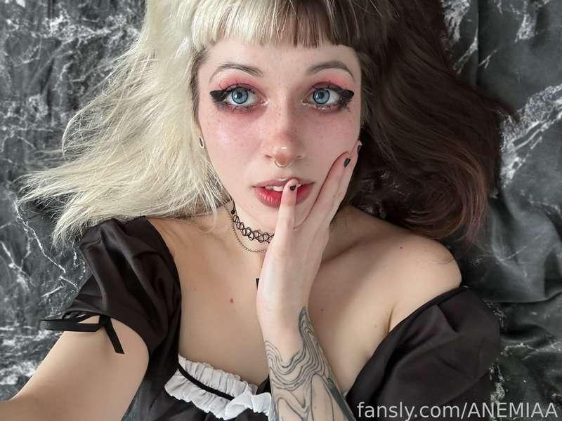 anemiaa image #2