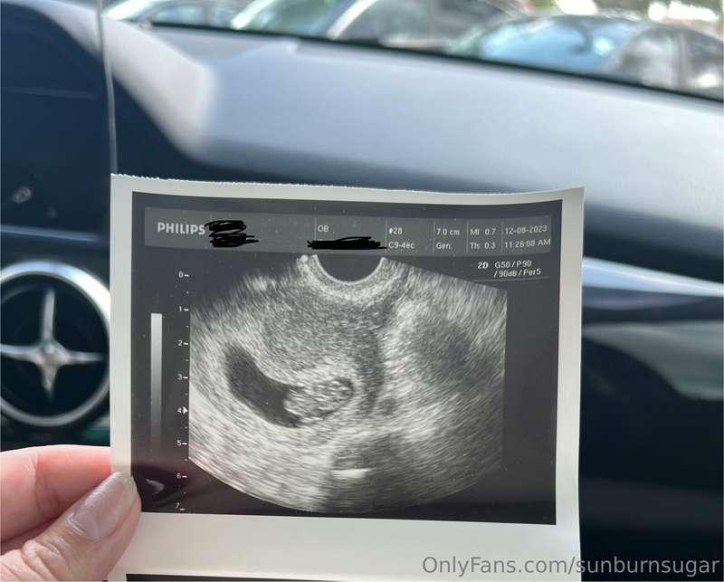 Anyone interested in pregnant x-rated content? 😏