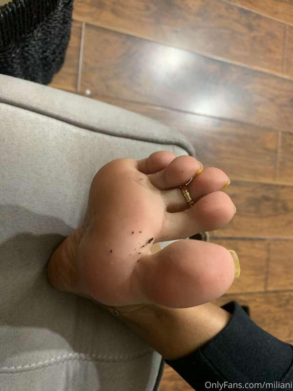Sock lint 😩
