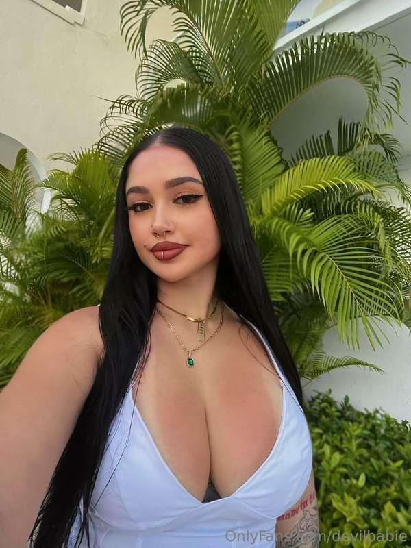 sunburnt 