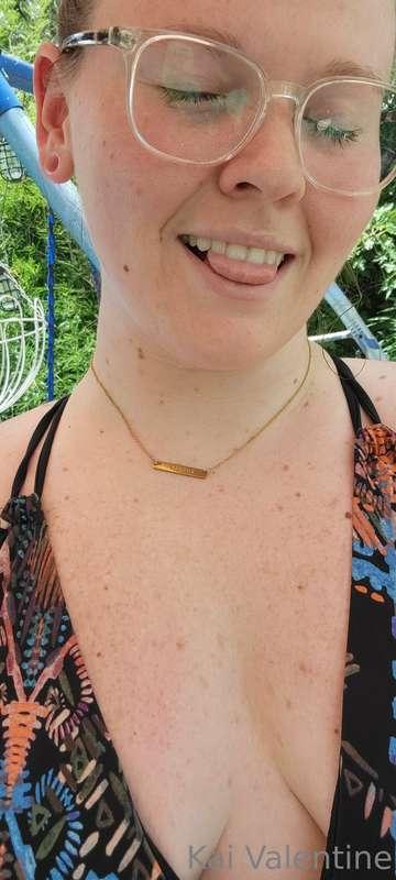 My fun day in the sun ended up very sunburnt.