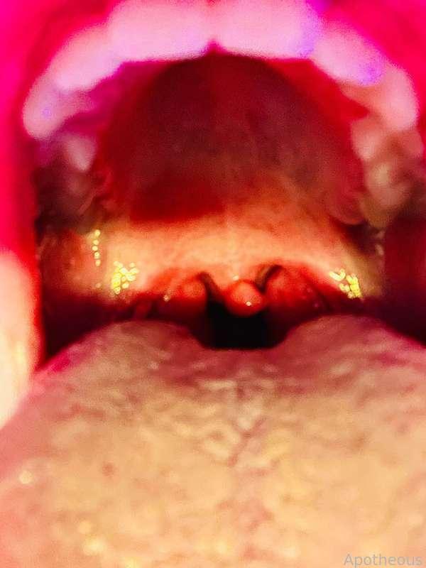 apotheous image #9