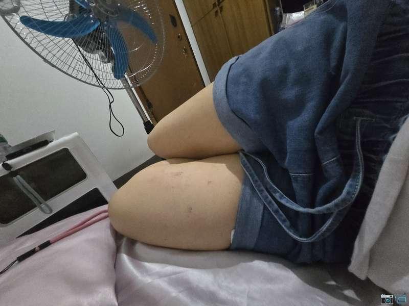 Lividi da cera ne abbiamo?
