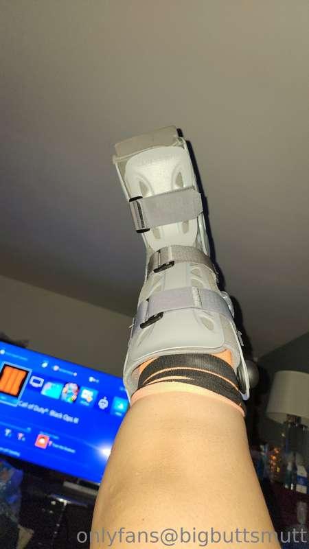 Yes...... My foot is still broken 😭