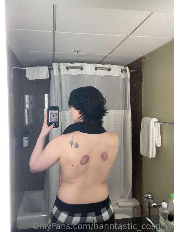 Guess who tried fire cupping this weekend?!   I went to a ki..