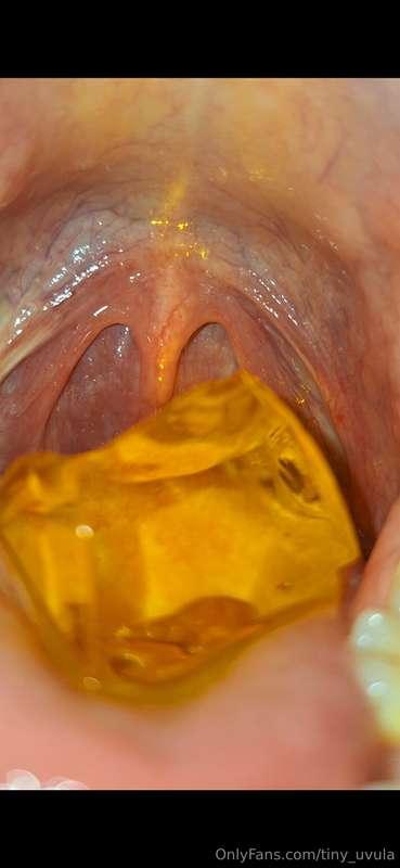 Something special...special light show inside my mouth. Look..