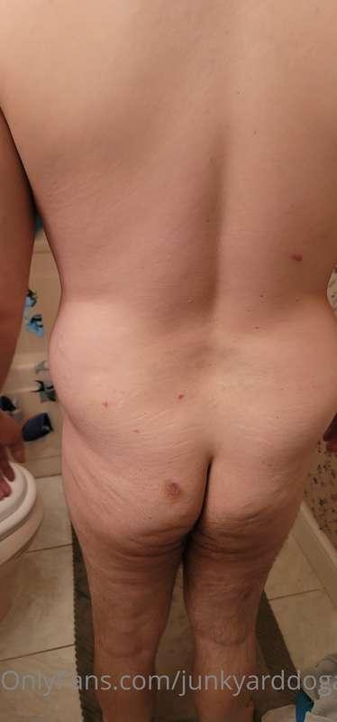 My bruised backside