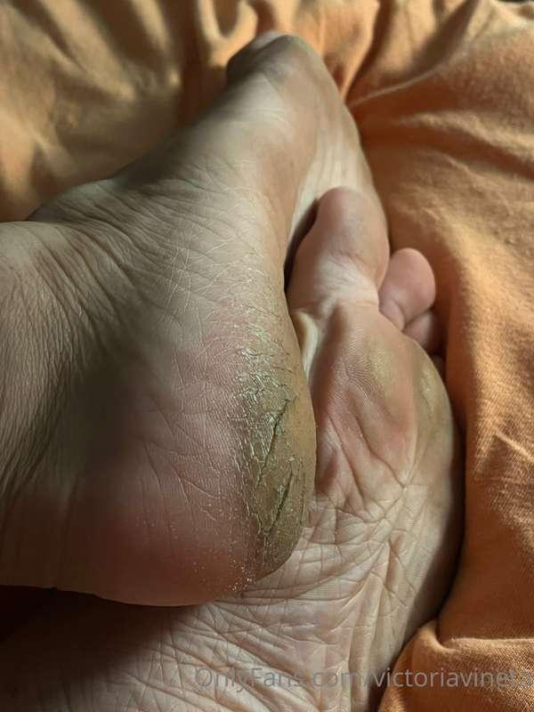 The sole today is a bit meaty and very cheesy. The flats of ..