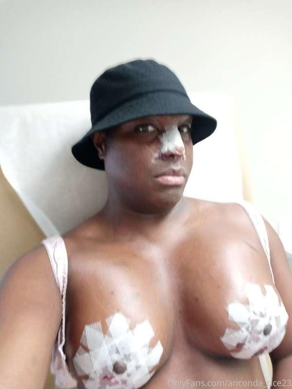 ❤HEY FANS I KNOW I'VE BEEN MIA BUT I WAS BUSY I HAD SURGERY ..