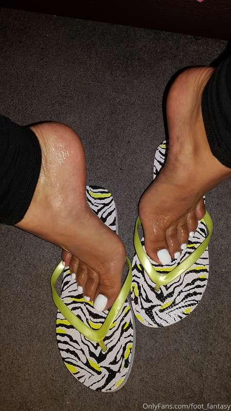 Oily feet in flip flops