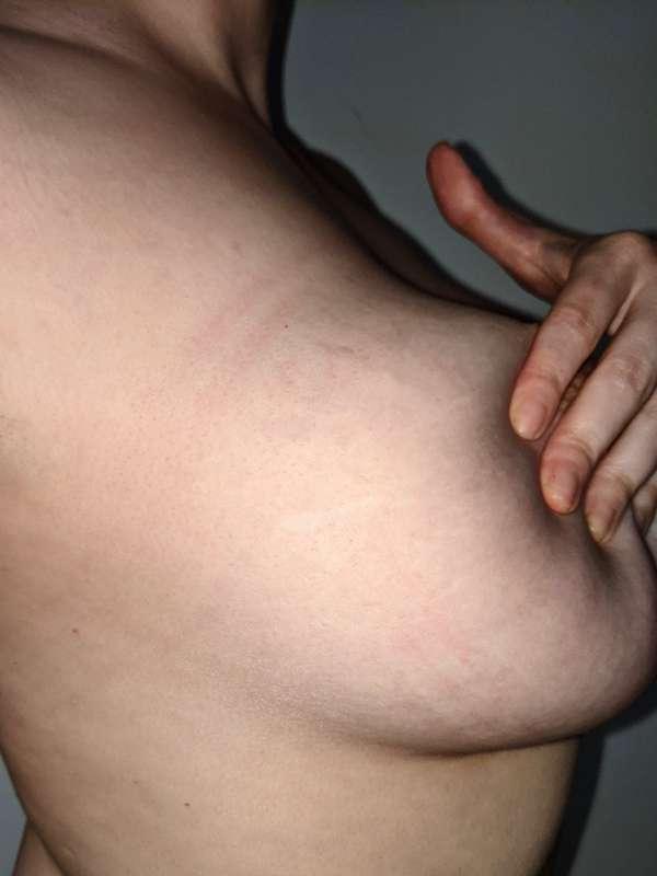 Can you see the rope marks? 👀