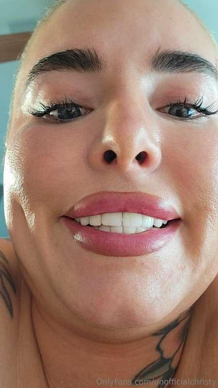Numbing my b-hole. Wyd?
