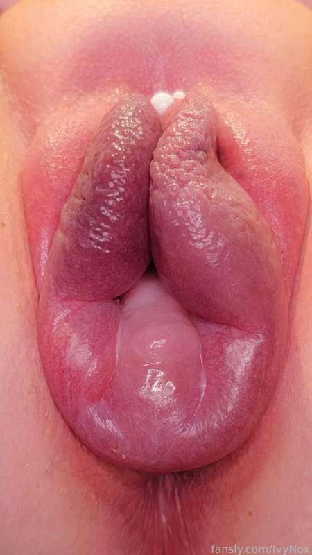 ivynox image #1