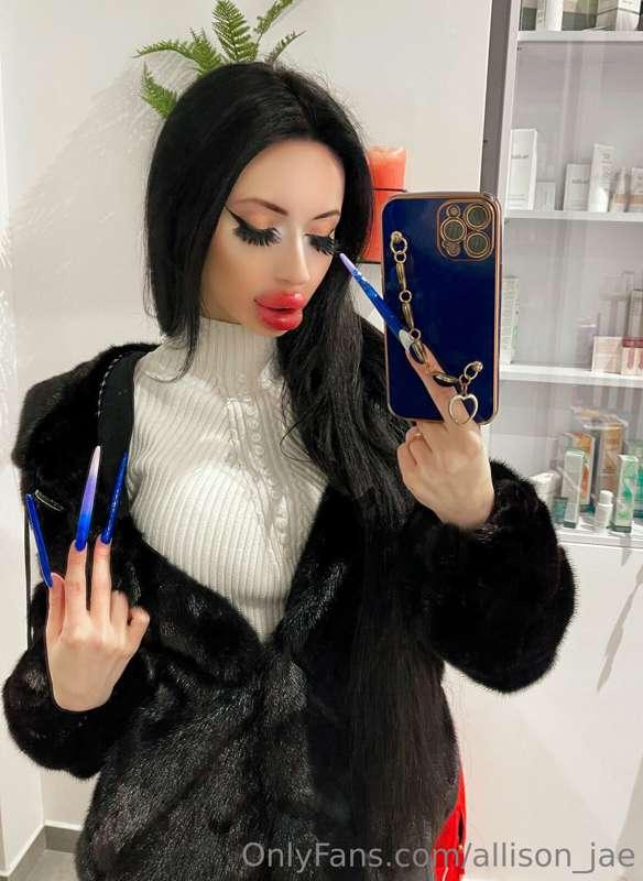 💋Transformation of my new lips💉How to stop, a couple more ti..
