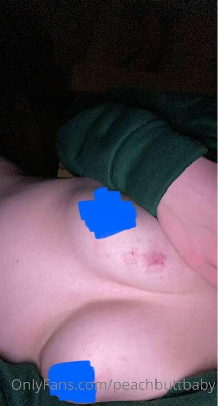 @peachbuttbabe rough night
