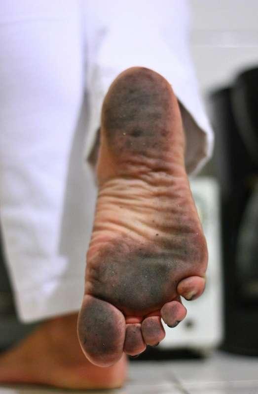 Black and White Dirty Feet