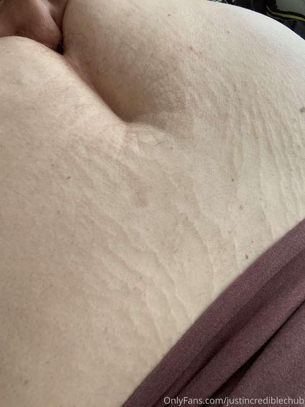 I find stretch marks on my ass kinda hot as well as the pers..
