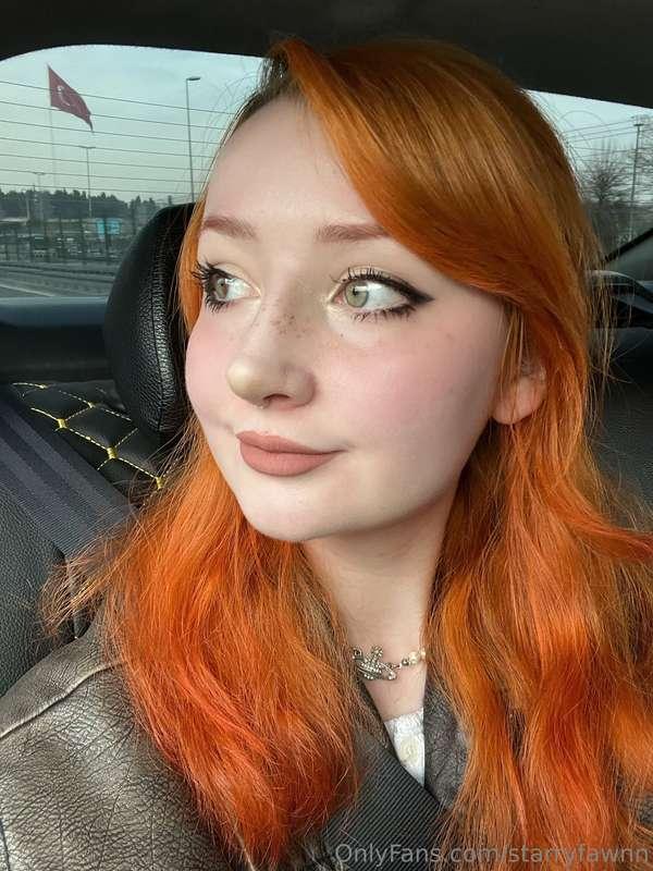 New nose reveal! Well sorta, she is still swollen and a lil ..