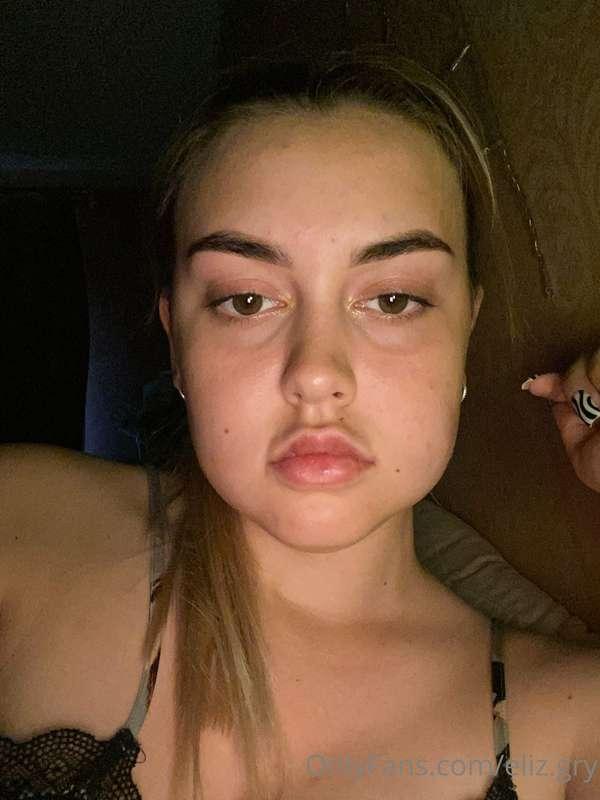 🤕