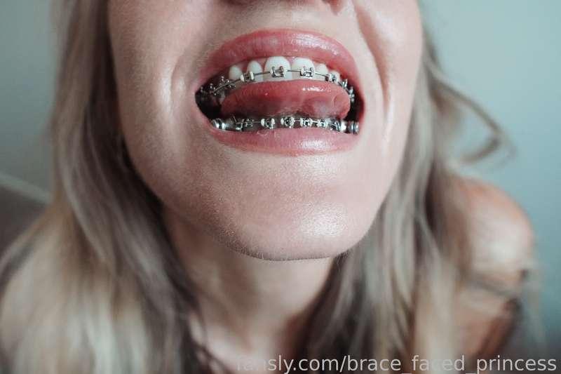 brace_faced_princess image #3
