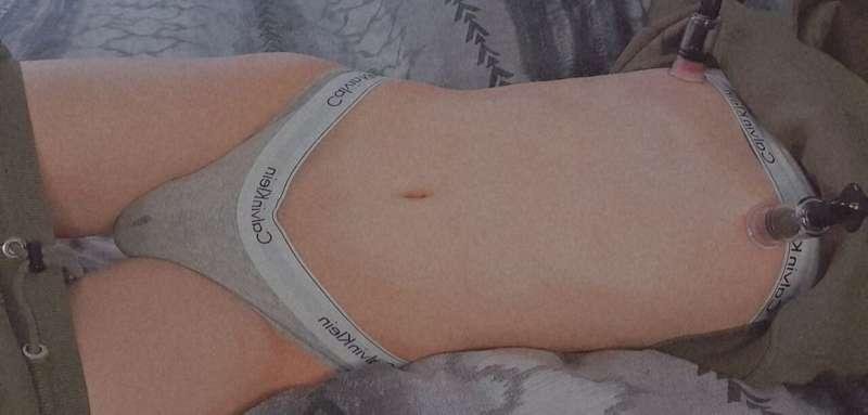 stephsis image #0