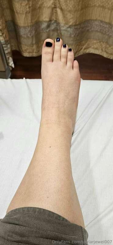 Getting x-rays

Bruising more visible in 2nd pict