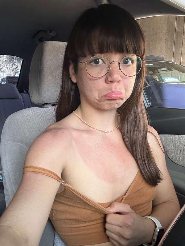 Uh oh, got a bit burnt at the beach today🥺☀️
Can anybody rub..