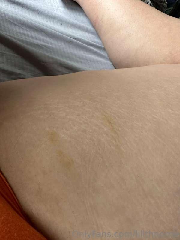 His marks 🥵