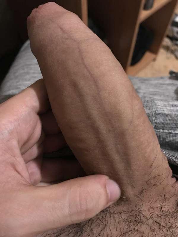 🙈